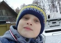 Синдром ди джорджа с отсутствием тимуса