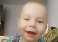 Синдром ди джорджа с отсутствием тимуса