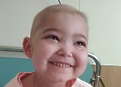 Синдром ди джорджа с отсутствием тимуса