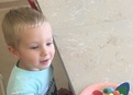 Синдром ди джорджа с отсутствием тимуса