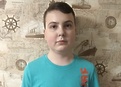 Синдром ди джорджа с отсутствием тимуса