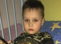 Синдром ди джорджа с отсутствием тимуса