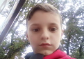 Синдром ди джорджа с отсутствием тимуса