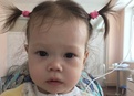Синдром ди джорджа с отсутствием тимуса